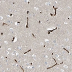 Immunohistochemical staining of human cerebral cortex shows strong membranous cytoplasmic positivity in endothelial cells.
