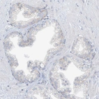 Immunohistochemical staining of human prostate shows no positivity in glandular cells as expected.