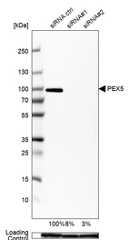 Western blot analysis in U2OS cells transfected with control siRNA, target specific siRNA probe #1 and #2, using Anti-PEX5 antibody. Remaining relative intensity is presented. Loading control: Anti-GAPDH.