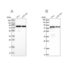 Western blot analysis using Anti-PEX5 antibody HPA039260 (A) shows similar pattern to independent antibody HPA039259 (B).
