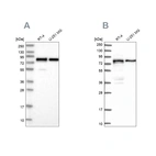 Western blot analysis using Anti-PEX5 antibody HPA039260 (A) shows similar pattern to independent antibody HPA039259 (B).