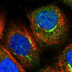 Immunofluorescent staining of human cell line A-431 shows localization to cytosol & the Golgi apparatus.