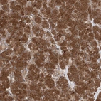 Immunohistochemical staining of human pancreas shows strong cytoplasmic positivity in exocrine glandular cells.