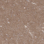 Immunohistochemical staining of human cerebral cortex shows moderate cytoplasmic positivity in neuropil.