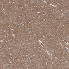 Immunohistochemical staining of human cerebral cortex shows moderate cytoplasmic positivity in neuropil.