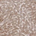 Immunohistochemical staining of human liver shows moderate cytoplasmic /cytoplasmic granular positivity in hepatocytes.