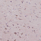 Immunohistochemical staining of human cerebral cortex shows moderate cytoplasmic positivity in subset of neuronal cells in addition to nucleoli expression.