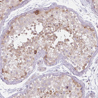 Immunohistochemical staining of human testis shows moderate cytoplasmic and nuclear membranous positivity in cells in seminiferous ducts.