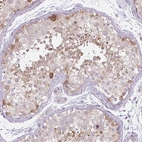 Immunohistochemical staining of human testis shows moderate cytoplasmic and nuclear membranous positivity in cells in seminiferous ducts.