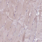 Immunohistochemical staining of human skeletal muscle shows no positivity in myocytes.