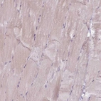 Immunohistochemical staining of human skeletal muscle shows no positivity in myocytes.