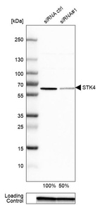 Western blot analysis in Caco-2 cells transfected with control siRNA, target specific siRNA probe #1, using Anti-STK4 antibody. Remaining relative intensity is presented. Loading control: Anti-GAPDH.