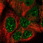 Immunofluorescent staining of human cell line CACO-2 shows localization to nucleoplasm, nuclear bodies & cytosol.