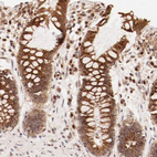 Immunohistochemical staining of human rectum shows strong positivity in cytoplasm granular in glandular cells.