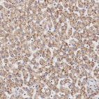 Immunohistochemical staining of human liver shows moderate positivity in cytoplasm granular in hepatocytes.