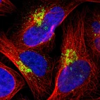 Immunofluorescent staining of human cell line U-2 OS shows localization to the Golgi apparatus.