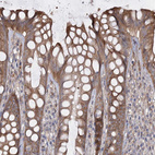Immunohistochemical staining of human rectum shows moderate cytoplasmic positivity in glandular cells.