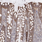 Immunohistochemical staining of human rectum shows moderate cytoplasmic positivity in glandular cells.
