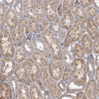 Immunohistochemical staining of human kidney shows moderate cytoplasmic positivity in cells in tubules.