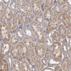 Immunohistochemical staining of human kidney shows moderate cytoplasmic positivity in cells in tubules.