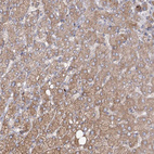 Immunohistochemical staining of human liver shows moderate cytoplasmic positivity in hepatocytes.