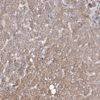 Immunohistochemical staining of human liver shows moderate cytoplasmic positivity in hepatocytes.