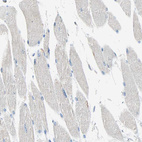 Immunohistochemical staining of human skeletal muscle shows no positivity in myocytes as expected.