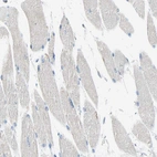 Immunohistochemical staining of human skeletal muscle shows no positivity in myocytes as expected.
