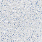 Immunohistochemical staining of human liver shows no positivity in hepatocytes as expected.