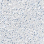 Immunohistochemical staining of human liver shows no positivity in hepatocytes as expected.