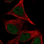 Immunofluorescent staining of human cell line RH-30 shows localization to nucleoplasm.