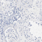 Immunohistochemical staining of human testis shows no cytoplasmic positivity in cells in seminiferous ducts as expected.
