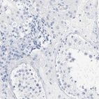 Immunohistochemical staining of human testis shows no cytoplasmic positivity in cells in seminiferous ducts as expected.