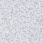 Immunohistochemical staining of human liver shows no cytoplasmic positivity in hepatocytes as expected.