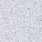 Immunohistochemical staining of human liver shows no cytoplasmic positivity in hepatocytes as expected.