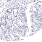 Immunohistochemical staining of human rectum shows no cytoplasmic positivity in glandular cells as expected.