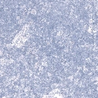 Immunohistochemical staining of human lymph node shows no cytoplasmic positivity in non-germinal center cells as expected.