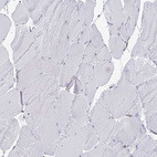 Immunohistochemical staining of human skeletal muscle shows no cytoplasmic positivity in myocytes as expected.