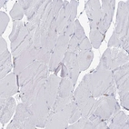 Immunohistochemical staining of human skeletal muscle shows no cytoplasmic positivity in myocytes as expected.