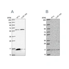 Western blot analysis using Anti-MRPS16 antibody HPA050081 (A) shows similar pattern to independent antibody HPA054538 (B).