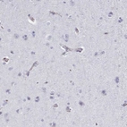 Immunohistochemical staining of human cerebral cortex shows weak membranous positivity in endothelial cells.