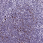 Immunohistochemical staining of human tonsil tissue shows moderate membranous positivity in subset of germinal center cells.