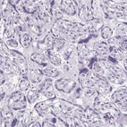 Immunohistochemical staining of human placenta shows no positivity in trophoblastic cells as expected.