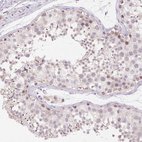 Immunohistochemical staining of human testis shows moderate nuclear positivity in subset of cells in seminiferous ducts.