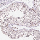 Immunohistochemical staining of human testis shows moderate nuclear positivity in subset of cells in seminiferous ducts.