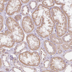 Immunohistochemical staining of human kidney shows moderate cytoplasmic/cytoplasmic granular positivity in cells in tubules.