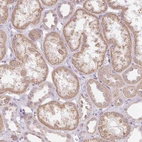 Immunohistochemical staining of human kidney shows moderate cytoplasmic/cytoplasmic granular positivity in cells in tubules.