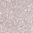 Immunohistochemical staining of human liver shows weak cytoplasmic positivity in hepatocytes.