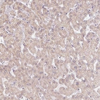 Immunohistochemical staining of human liver shows weak cytoplasmic positivity in hepatocytes.