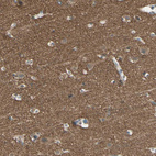 Immunohistochemical staining of human cerebral cortex shows strong granular cytoplasmic positivity in neuropil.